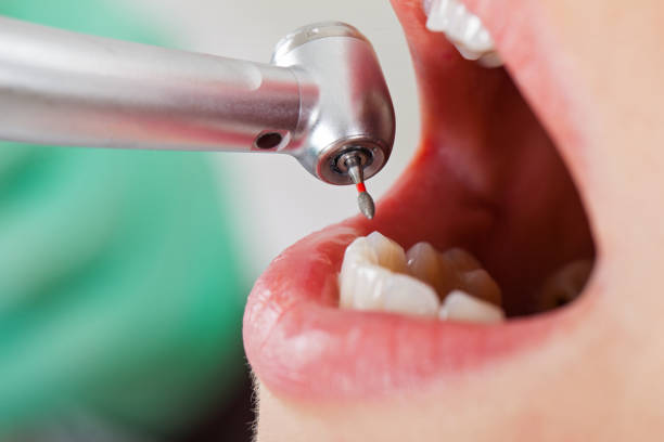 Best Broken or Chipped Tooth Repair in Faribault, MN